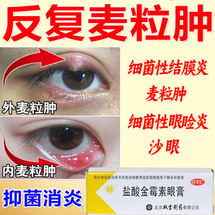 双吉 盐酸金霉素眼膏 2.5g*1支细菌性结膜炎麦粒肿眼睑炎眼睛红肿