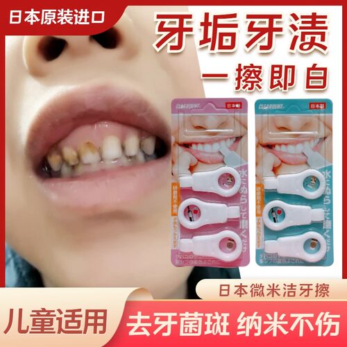 日本儿童洁牙擦微米洁牙擦去牙渍祛除牙菌斑去黑斑神器牙斑净海绵