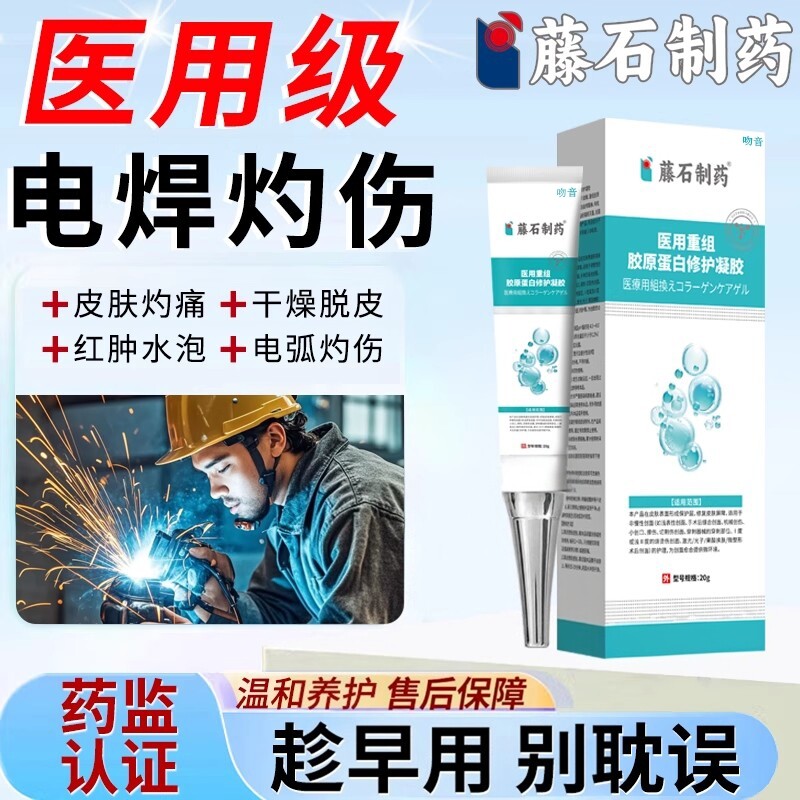 电焊工脸灼伤发红干燥脱皮专用电弧烧伤烫伤膏刺痛保湿药房同款YZ
