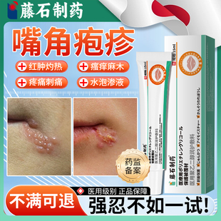嘴唇疱疹单纯病毒性嘴巴上火起水泡烂嘴角开裂口角炎药房同款膏HT