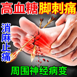 高血糖尿病脚刺痛周围神经病变药房同款治疗仪手脚麻木专用喷剂YZ
