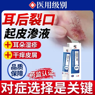 耳后外耳道湿疹耳朵后痒烂起皮耳根裂口开裂真菌感染药房同款膏HT