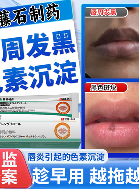 嘴唇黑斑黑色素去除唇周黑点改善淡化嘴角周围暗沉去黑色素沉淀VQ