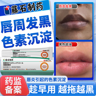嘴唇黑斑黑色素去除唇周黑点改善淡化嘴角周围暗沉去黑色素沉淀VQ