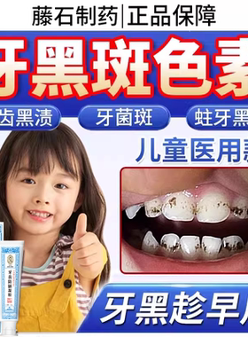 儿童牙膏牙黑斑去除牙齿黑色素沉淀祛除黑渍牙菌斑去渍美白医用TU