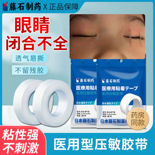 睡觉眼睛眼睑闭合不全闭眼贴暴露性角膜炎畏光流泪眼罩医用胶布TU