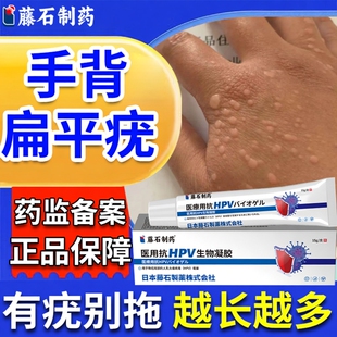 医用手背扁平疣软膏丝状疣瘊尤脖子上长小肉粒点药房同售水DS