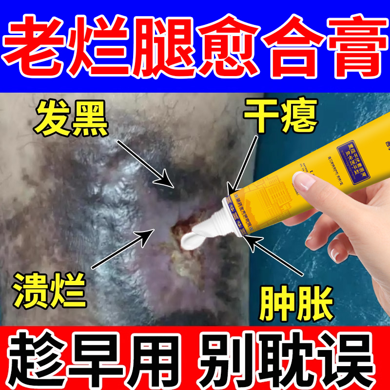 【藏族秘方】老烂腿专用膏