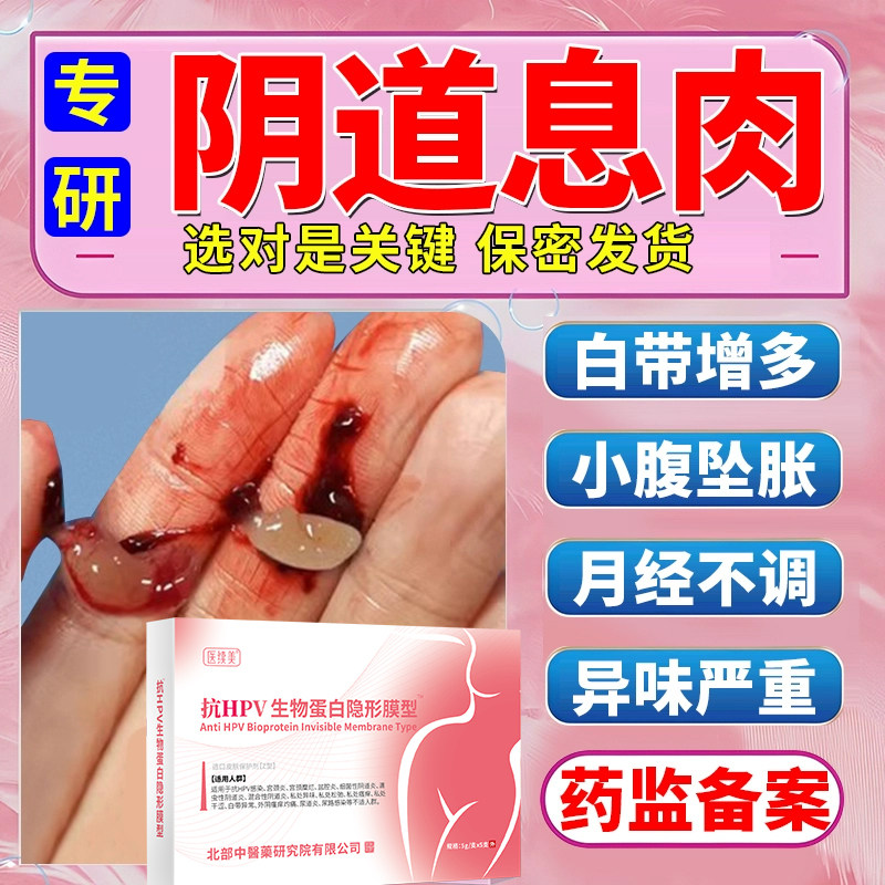 阴道息肉阴道炎妇科凝胶霉菌性细菌滴虫性白带增多宫颈糜烂瘙痒YZ