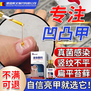 指甲凹凸不平修复液竖纹调理受损再生养甲床甲肉分离真菌感染YZ