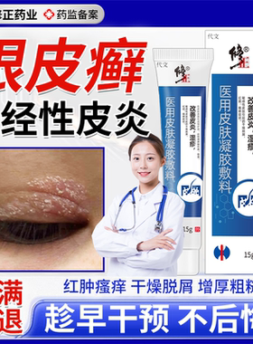 眼皮癣神经性皮炎眼皮红肿痒眼睛周围过敏发痒眼角干燥起皮掉屑VQ