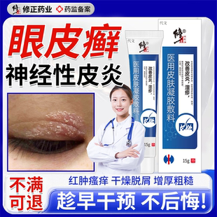 眼皮癣神经性皮炎眼皮红肿痒眼睛周围过敏发痒眼角干燥起皮掉屑VQ