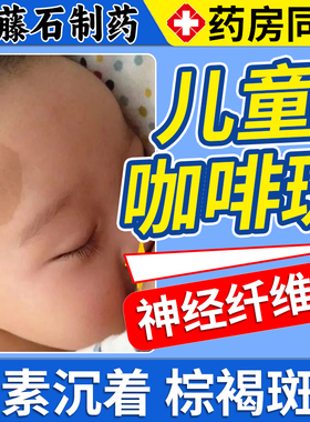 儿童牛奶咖啡斑胎记去除神经性纤维瘤药监备案膏克星激光防晒贴DS