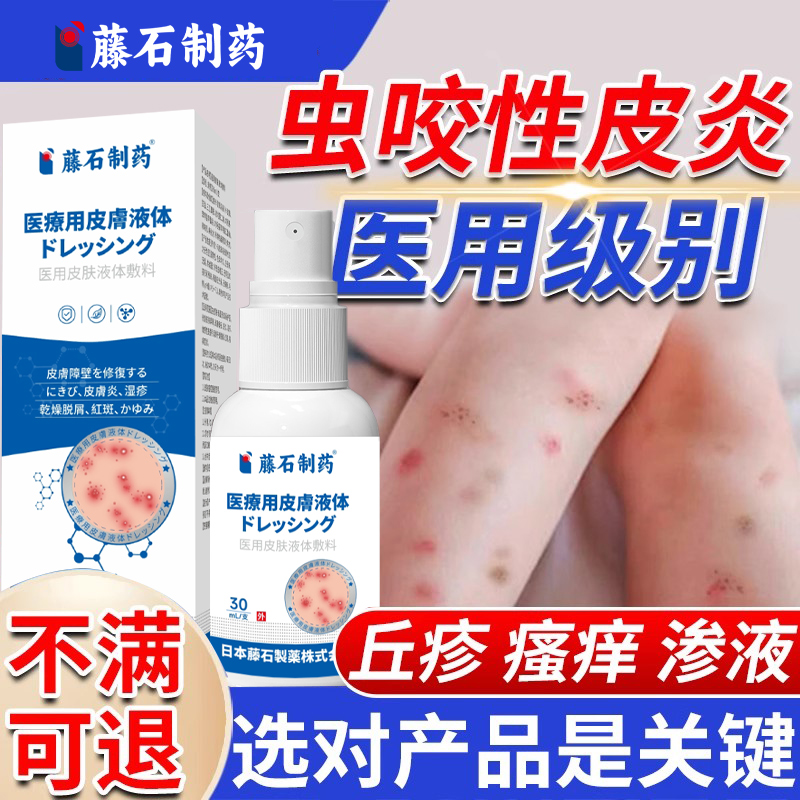 虫咬性皮炎红肿瘙痒丘疹水泡
