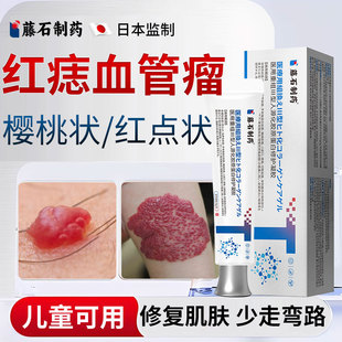 红痣血管瘤婴儿樱桃状血管痣蜘蛛痣去除专用凝胶药房同款乳膏YZ