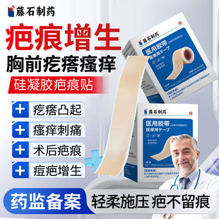 胸口增生疤痕凸起硬肉去除疙瘩止痒软化针止痒乳药膏压力隐形贴YZ