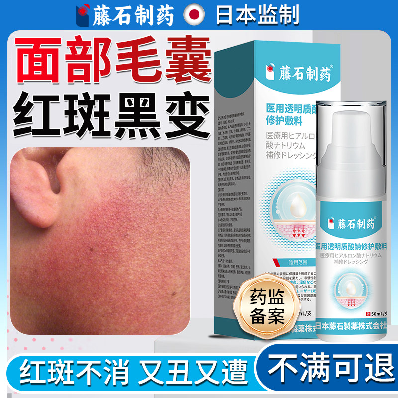 儿童可用脸颊有小疙瘩鸡皮肤