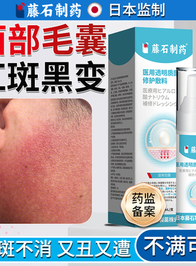 面颈部毛囊红斑黑变病面部脸颊两边有起小疙瘩毛周角化症儿童HT