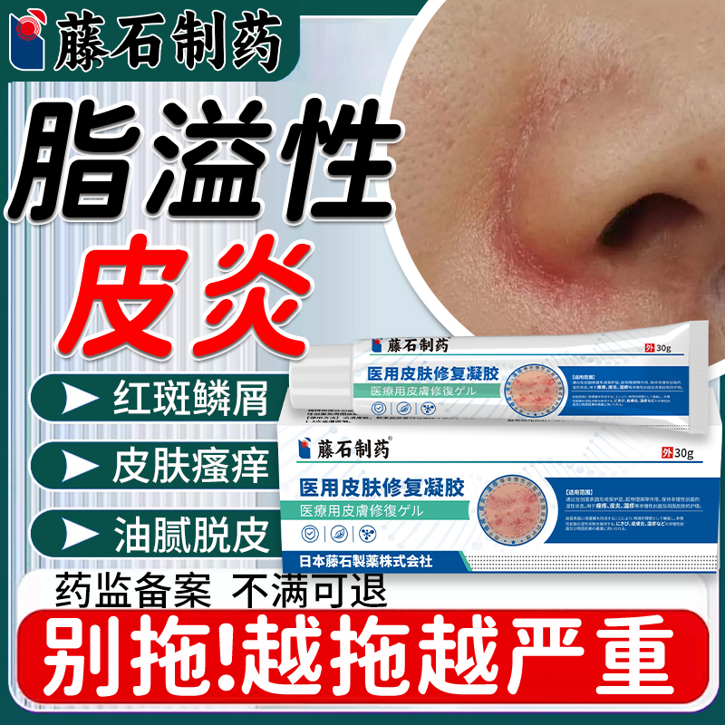 藤石制药脂溢性皮炎修复软膏