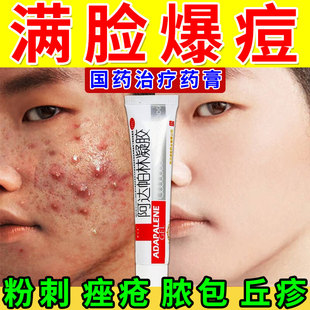 阿达帕林凝胶祛痘痘药膏脸上起痘痘小疙瘩痤疮粉刺丘疹祛痘内调MT