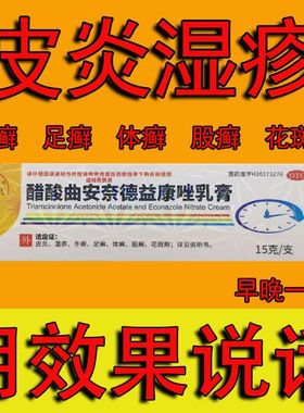 醋酸曲安奈德益康唑乳膏药膏软膏锉挫曲安纳奈德曲奈安德德康唑