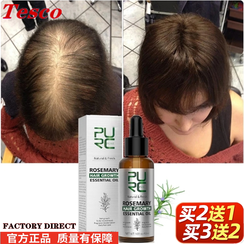 Purc Rosemary Ginger Hair Growth essential oil Fast Regrowth
