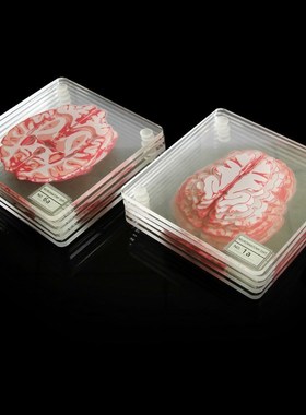 Brain Specimen Coasters Set 3D Organ Brain Artwork Brain Sli
