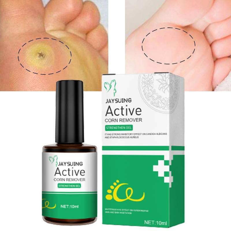 Effectively Remove Warts Foot Corn Essence Mild Remoal Corns