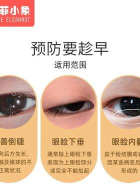 儿童倒睫毛矫正贴敏宝零感觉低超宝薄上眼睑NHX拉倒睫提毛贴神器