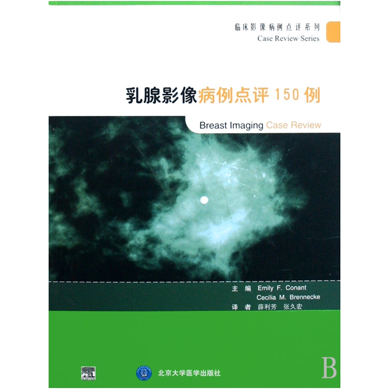 乳腺影像病例点评150例/临床影像病例点评系列 书籍/杂志/报纸 妇产科学 原图主图