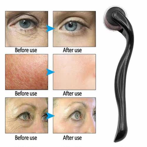 Micro Needle 540 Roller Men Beard Growth Hair Regrowth Beard