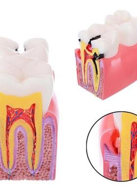 Modèle de dents d éducation d anatomie d