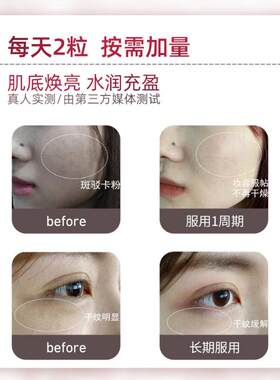 澳洲进口胶Unich原i玫胶小熊ZYQ软糖美瑰颜保健品补充原蛋白60粒