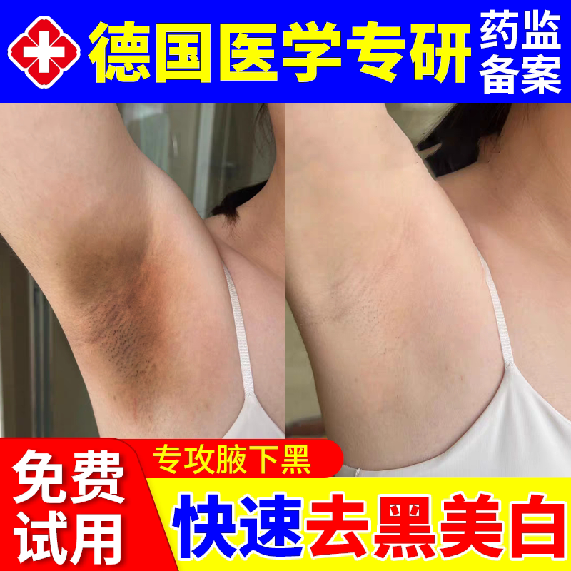 腋下去黑美白腋窝除黑色