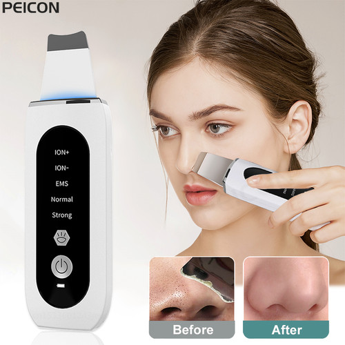 Ultrasonic Skin Scrubber Peeling Blackhead Remover Deep Face