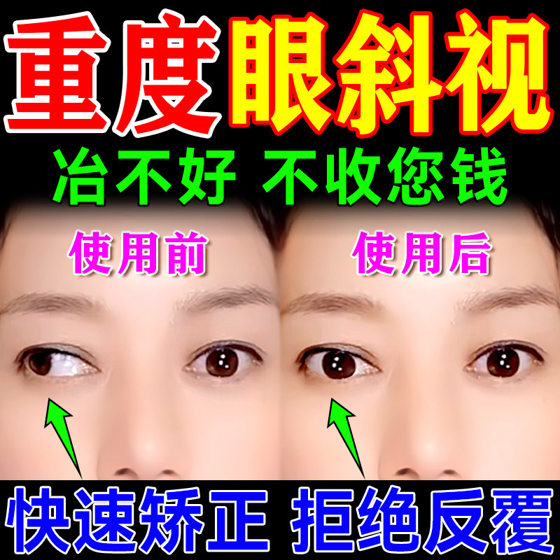 斜视矫正训练器聚散球视力眼罩贴工具儿童眼睛内外斜视鸡斗眼药水