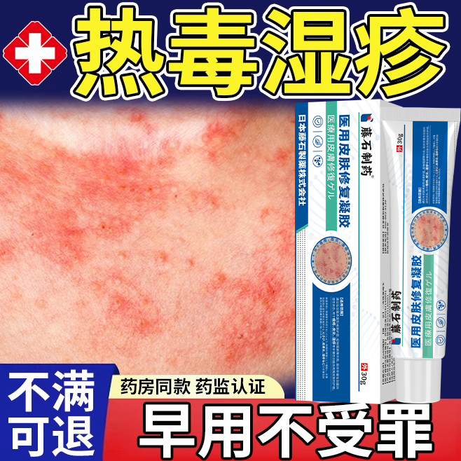湿疹皮炎瘙痒软膏【药监备案】