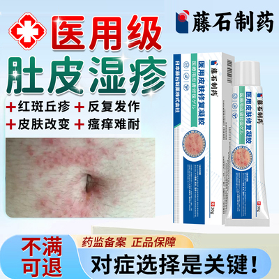 肚皮湿疹瘙痒止痒除湿
