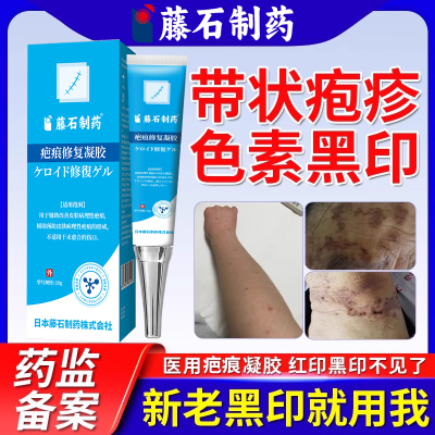 带状疱疹留黑印色素沉淀专用