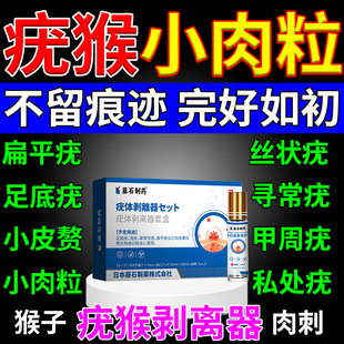疣体剥离器套盒刀疣瘊肉粒去猴子一抹无忧去祛除神器疙瘩肉刺膏YZ