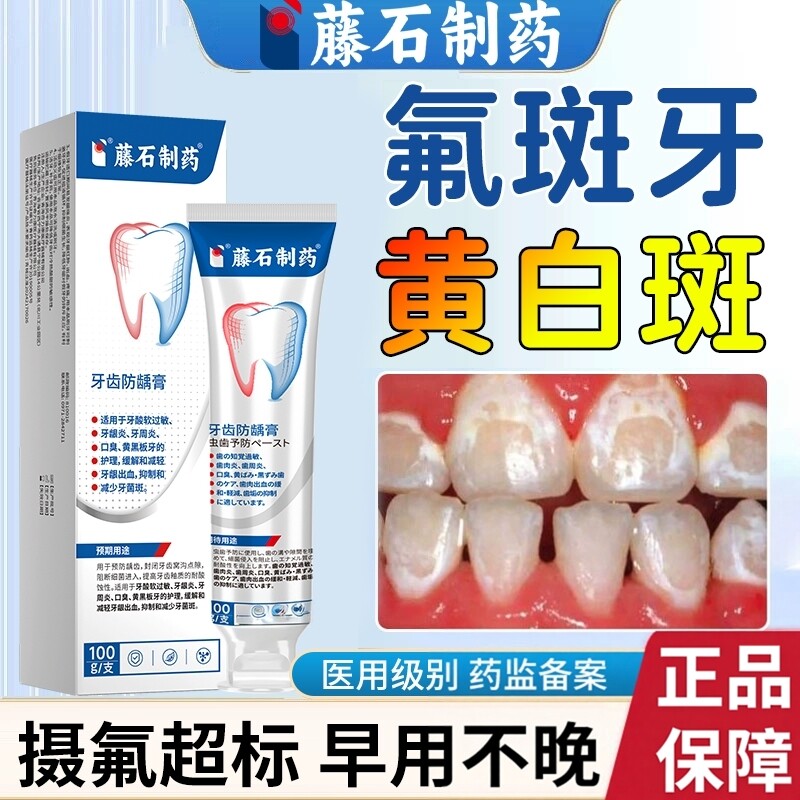 氟斑牙去除专用儿童变白神器稀盐酸牙齿脱矿白斑钙化可搭牙膏用DS