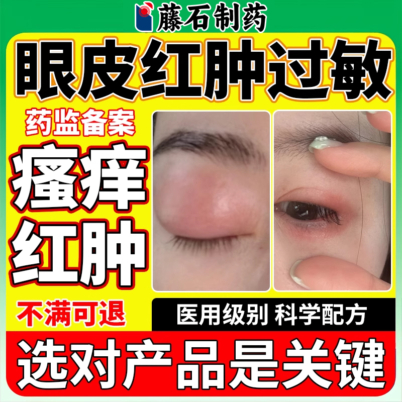 眼皮红肿痒眼睛周围过敏
