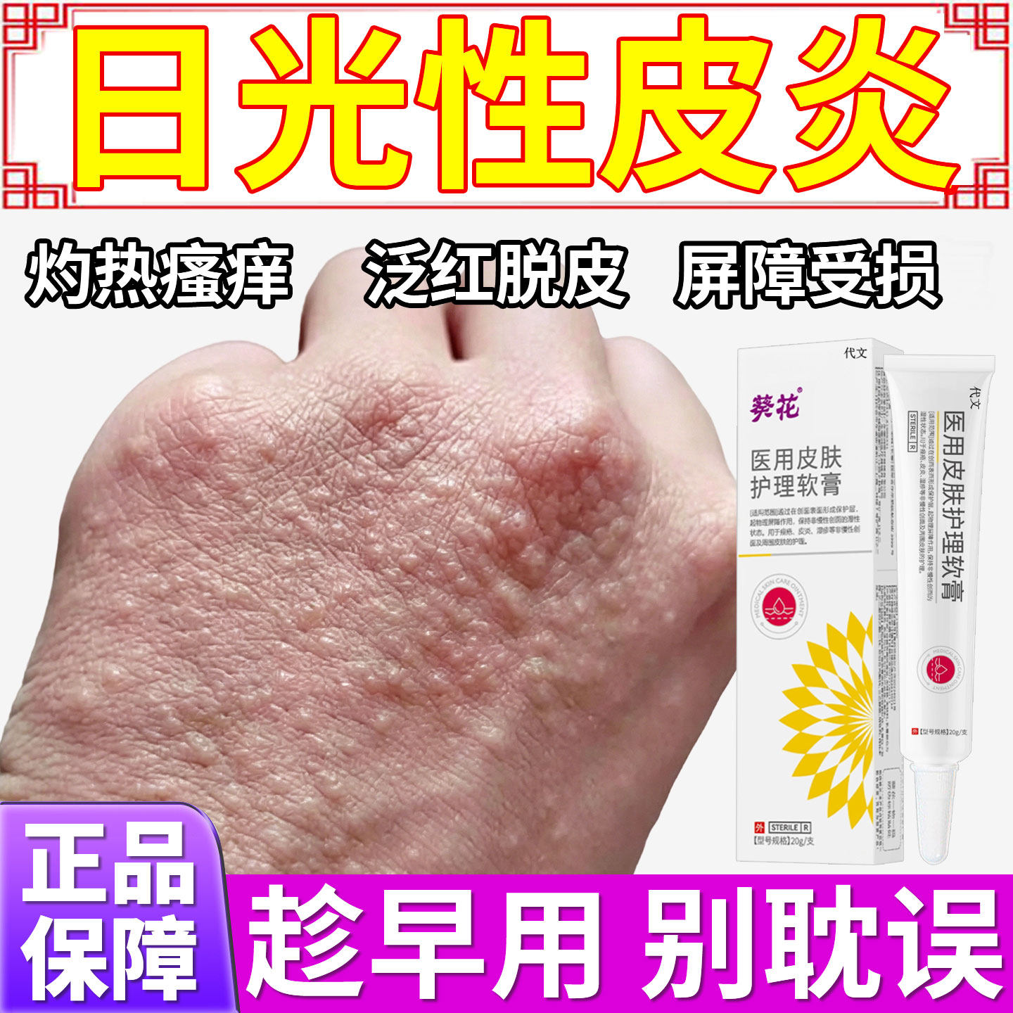 日光性皮炎紫外线过敏专用太阳晒伤皮肤发痒修复霜药房同款膏YZ