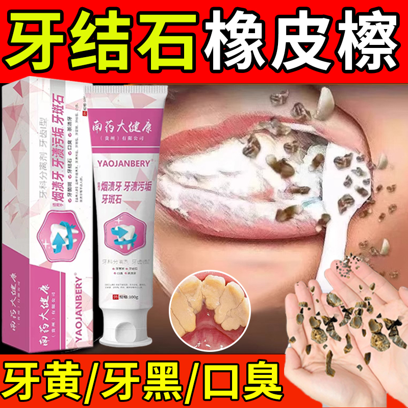 【牙医推荐】医用级祛牙结石牙膏