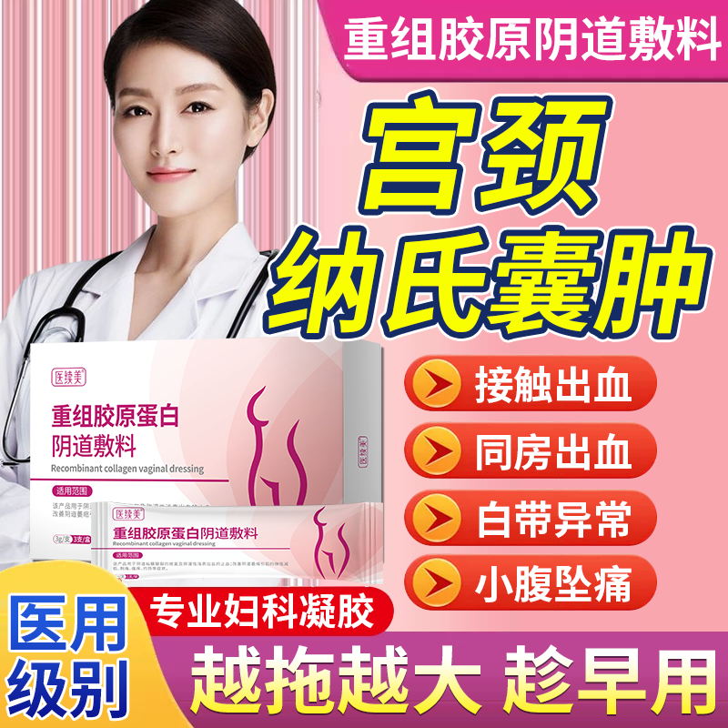 宫颈纳氏囊肿多发纳囊妇科凝胶阴道接触性出血子宫颈炎药房同款TU