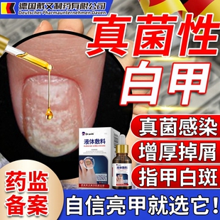 真菌性白甲银屑病指甲真菌感染脚趾甲增厚变黄甲癣专用药房同售VQ