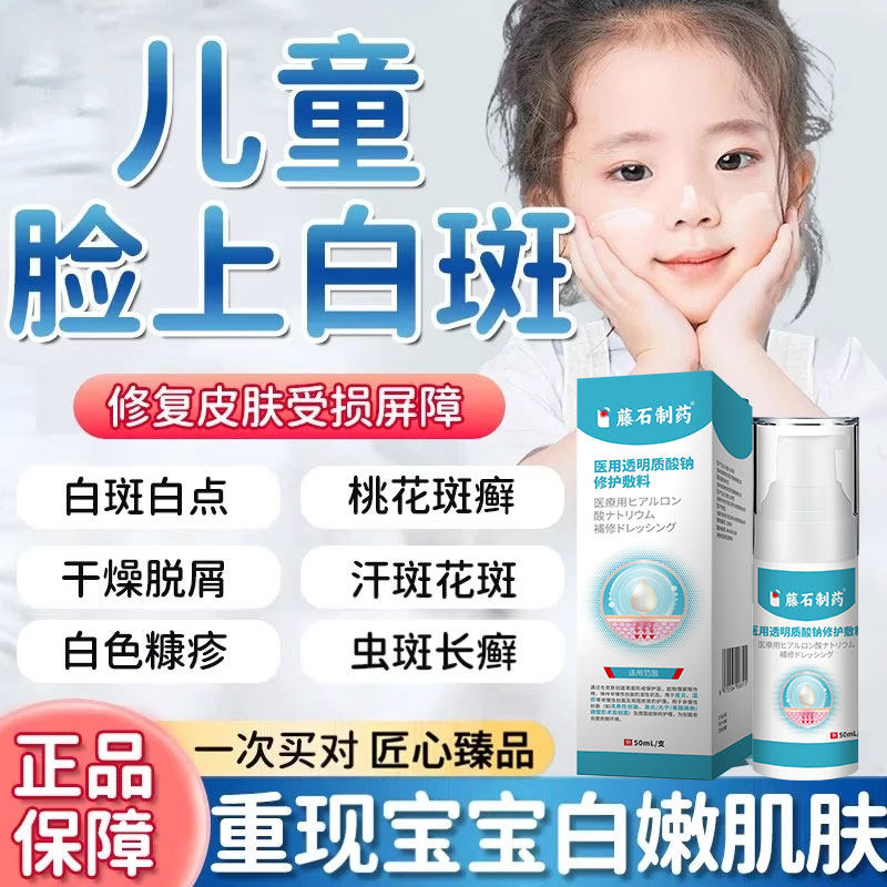 白色糠疹儿童脸部脸上长白斑维生素e乳膏汗斑桃花癣药房同款膏YZ