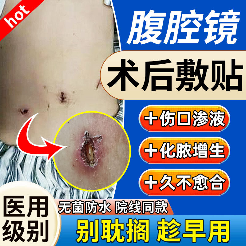 腹腔镜术后伤口防水贴阑尾炎刀口贴透气小号湿性无菌敷料贴医用TU