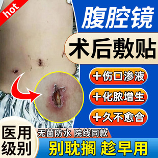 腹腔镜术后伤口防水贴阑尾炎刀口贴透气小号湿性无菌敷料贴医用TU