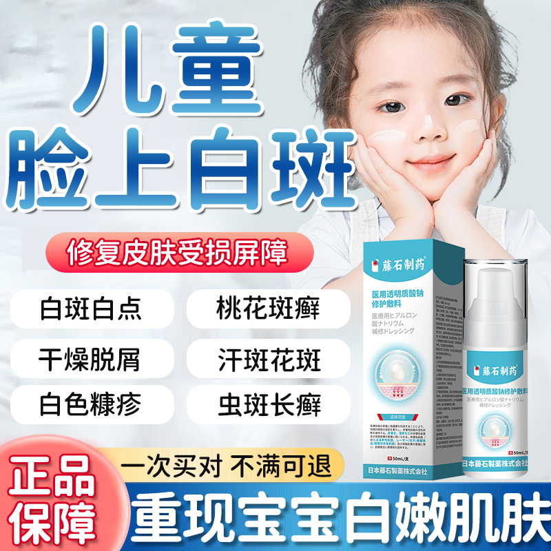 儿童白斑藤石透明质酸钠敷料